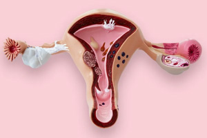 Gynaecology